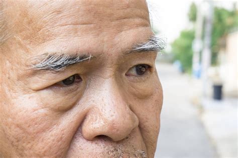 老人眉毛長|眉毛愈長愈長壽？醫揭真相 50歲後眉毛變長小心「4健康隱憂」